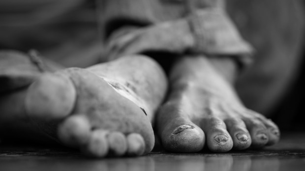 The feet of a old man living on the street.