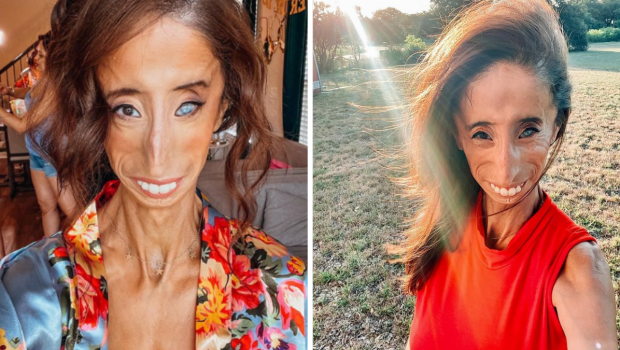 Lizzie Velazquez- najbrzydsza kobieta świata