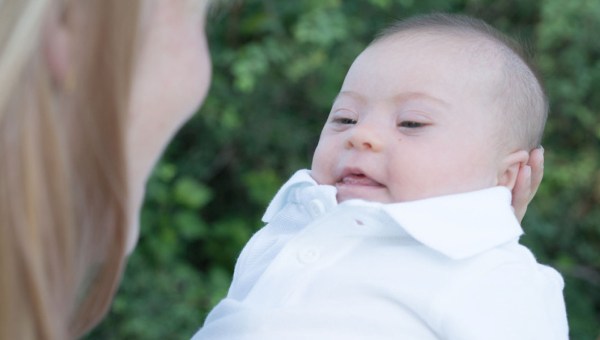 Niemowlę z zespołem downa