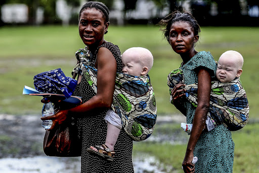 TANZANIA : Women carrying their albino children on May 5, 2014, in Dar es Salaam &#8211; es