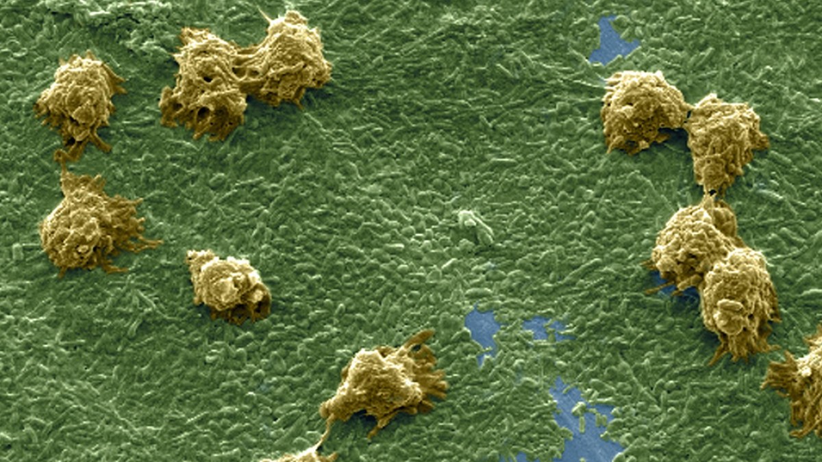 WEB3 KLEBSIELLA PNEUMONIAE BACTERY INDIA