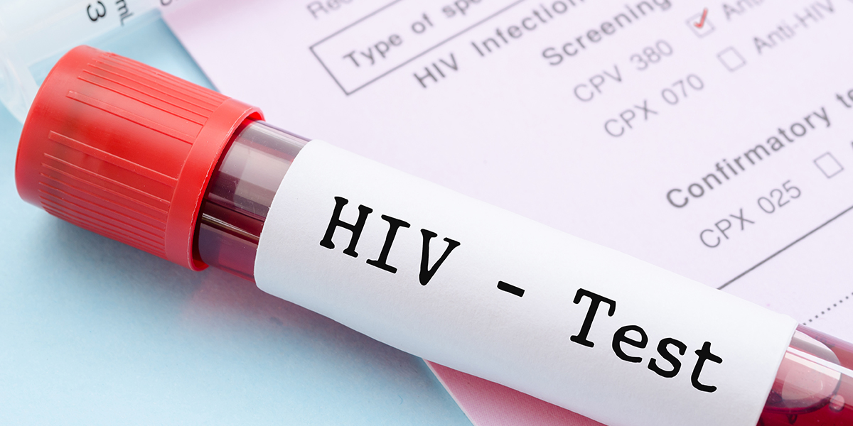 HIV, AIDS