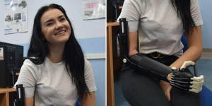 Kinga urodziła się bez ręki. Dostała ją od… kolegów z klasy