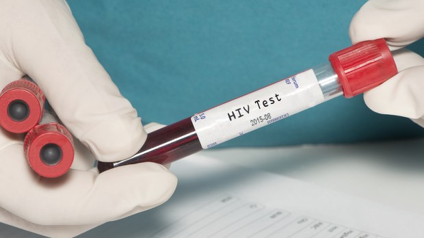 TEST NA HIV
