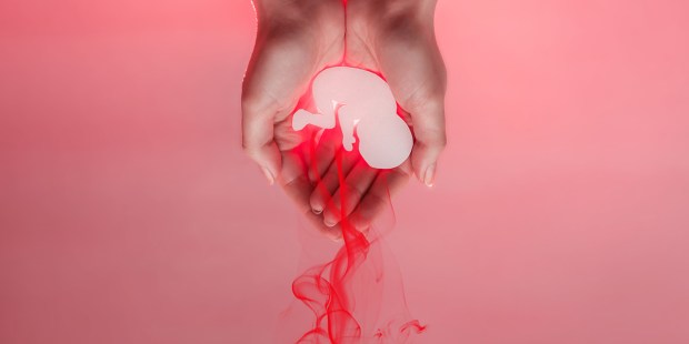 ABORCJA