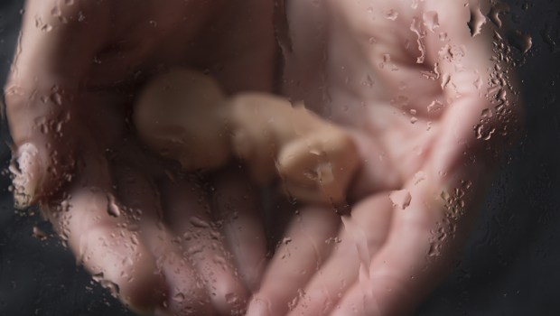 ABORCJA