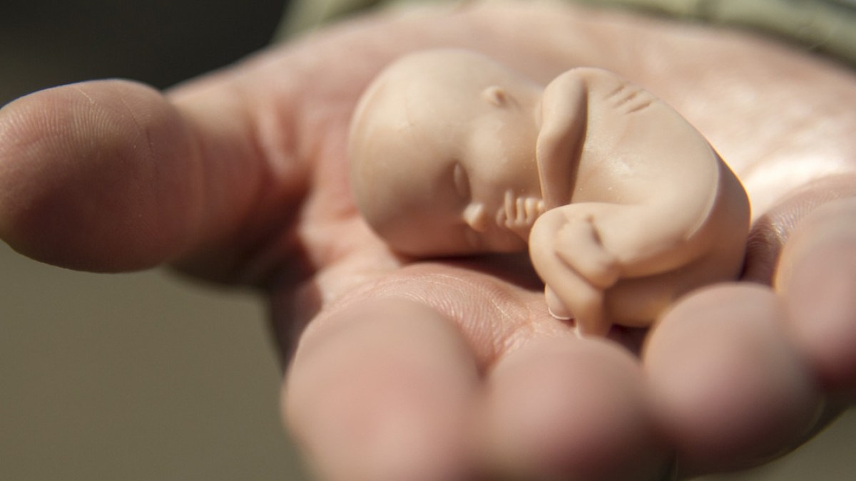 PRO LIFE