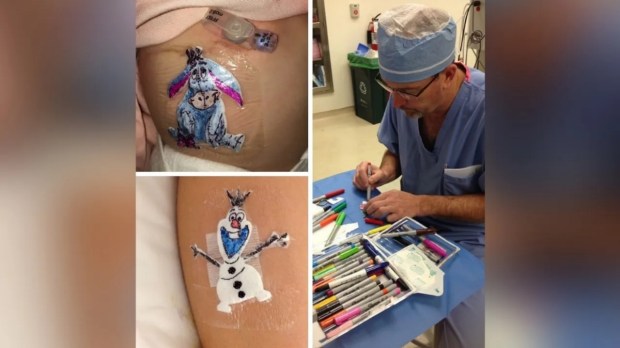 Chirurg ze szpitala dziecięcego rysuje kreskówki na bandażach wokół blizn swoich małych pacjentów