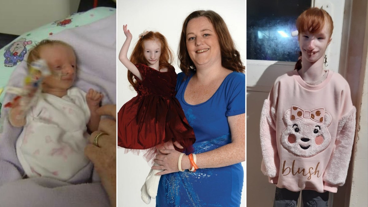 najmniejsza dziewczynka na świecie Charlotte skończyła 15 lat