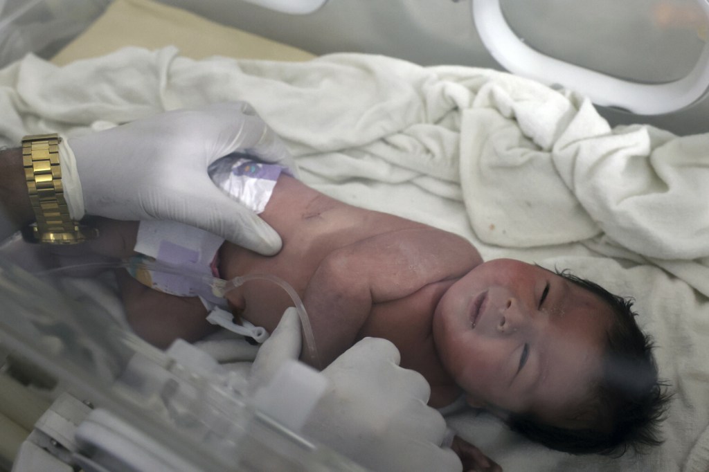 Urodzona pod gruzami dziewczynka trafiła do szpitala w Afrinie w prowincji Aleppo