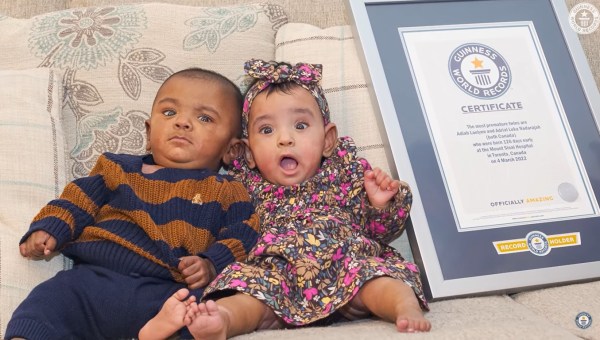 najmłodsze bliźnięta-wcześniaki na świecie