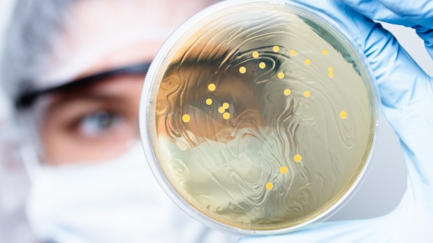 Naukowiec w kitlu, czepku i okularach patrzy na szalkę z bakteriami